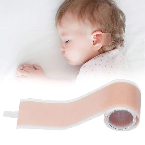 چسب اصلاح فرم گوش سیلیکونی نوزاد